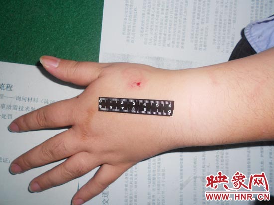 為幫助無(wú)證駕駛的朋友逃避處罰，新鄉(xiāng)的王某竟對(duì)執(zhí)勤民警大打出手，還將一名民警的手臂咬傷