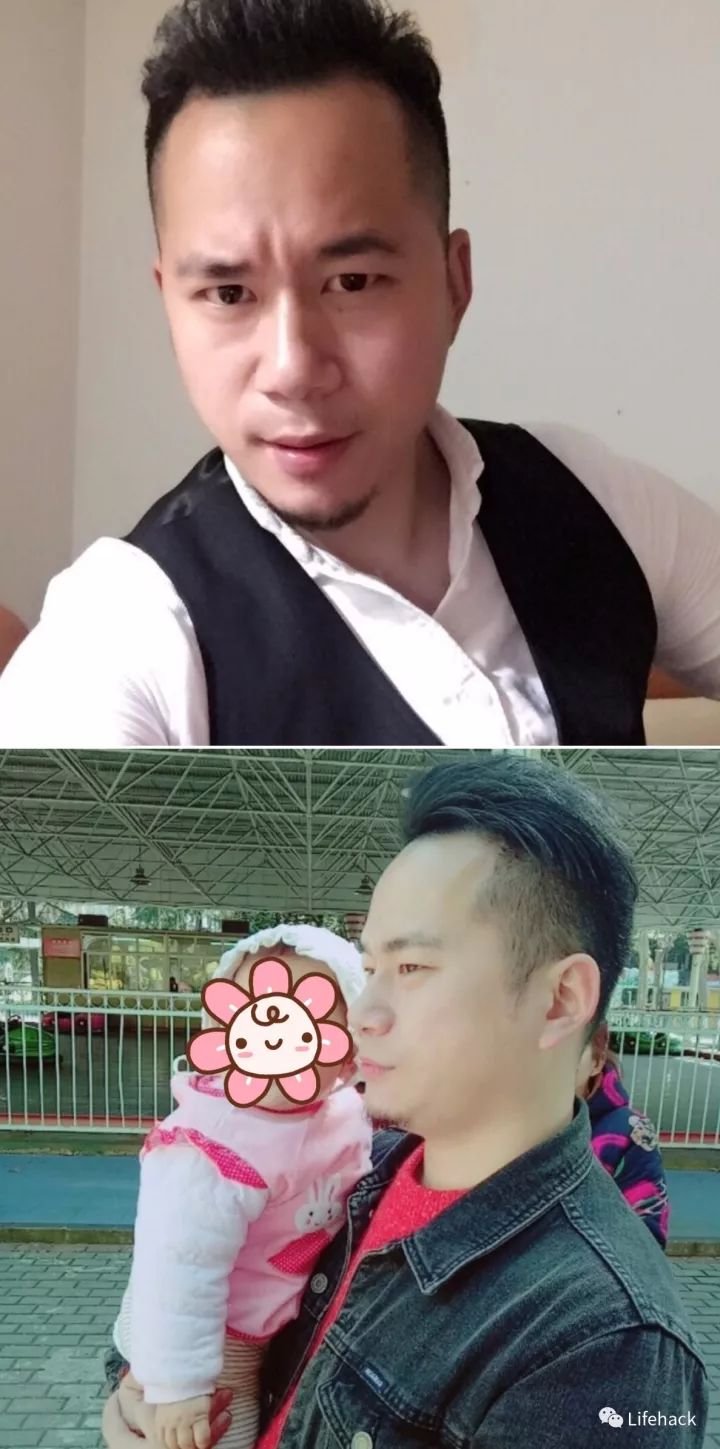 長胖20斤，臉型怎么變？這些例子看完扎心了！