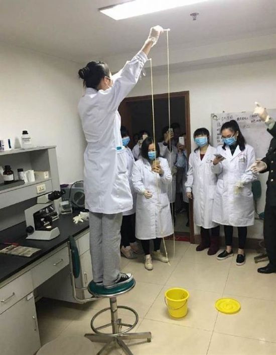 愛(ài)吃生肉惹的禍！男子體內(nèi)取出5米長(zhǎng)寄生蟲(圖)